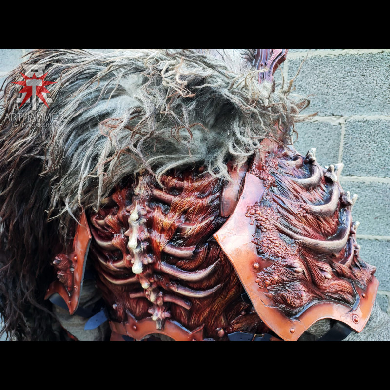 Bone backplate
