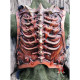 Bone backplate
